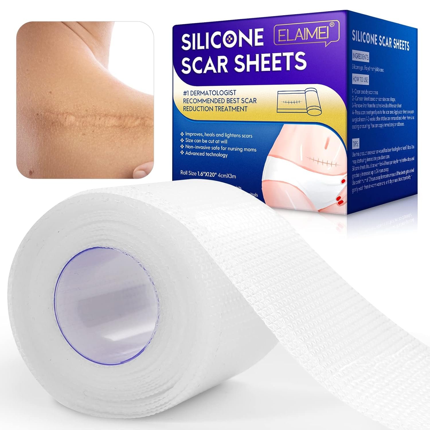 Silicone Scar Sheets – Silicone Scar Tape (1.6” x 120”), Invisible Medical Grade Scar Silicone Strips for Face, Transparent Removal Scar Patches for surgical scars, Keloids