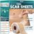 Silicone Scar Tape – 60″ x 1.6″ Roll – 1.5M, Scar Treatment for Improves Surgical, Keloid, Hypertrophic Scars – Medical Grade Reusable Silicone Scar Sheets
